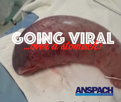 Going Viral Over A Stomach
